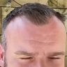 WheelersRecedingHairline