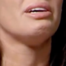 Rebekah Vardy's Chin